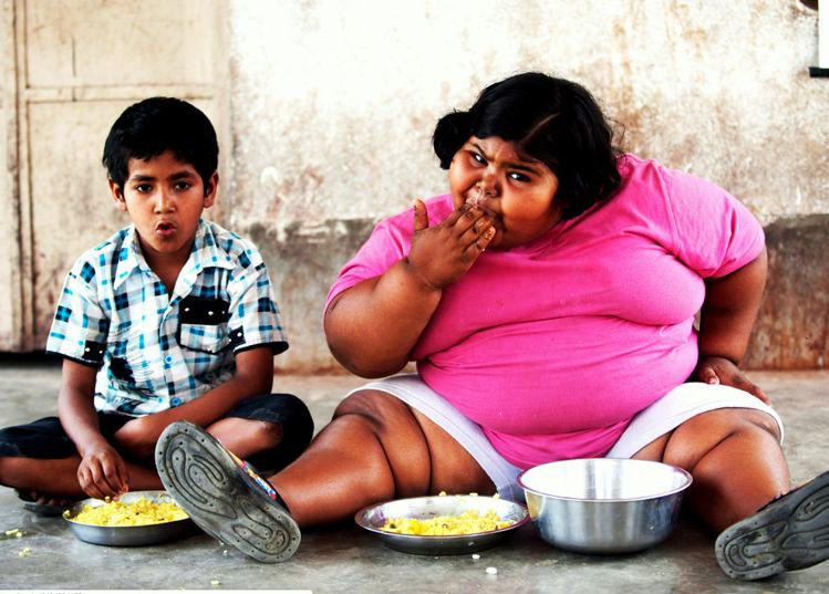 साधारण वजन Obesity